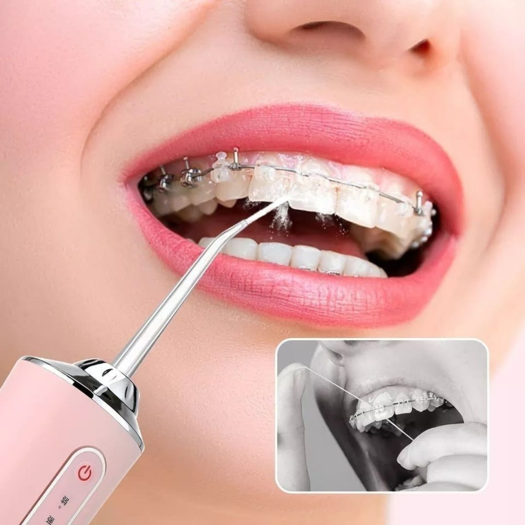 HydroDent Pro – Irrigador Dental Portátil