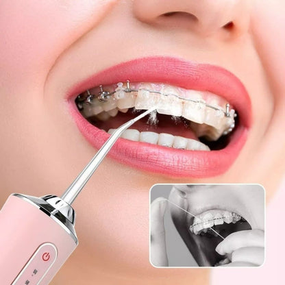 HydroDent Pro – Irrigador Dental Portátil